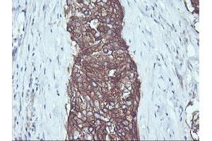 Image no. 1 for anti-V-Ral Simian Leukemia Viral Oncogene Homolog B (Ras Related, GTP Binding Protein) (Ralb) antibody (ABIN1500584) (RALB antibody)