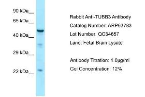 Western Blotting (WB) image for anti-Tubulin, beta 3 (TUBB3) (C-Term) antibody (ABIN971952) (TUBB3 antibody  (C-Term))