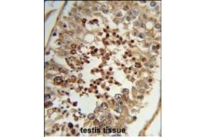 Formalin-fixed and paraffin-embedded human testis tissue reacted with TAC2N Antibody (N-term), which was peroxidase-conjugated to the secondary antibody, followed by DAB staining. (TC2N antibody  (N-Term))