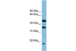 WB Suggested Anti-C11orf73 Antibody Titration: 0.
