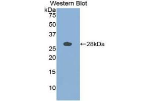 Detection of Recombinant CTSS, Bovine using Polyclonal Antibody to Cathepsin S (CTSS) (Cathepsin S antibody  (AA 115-331))