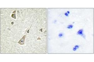 Immunohistochemistry analysis of paraffin-embedded human brain tissue, using PCDH-X/Y Antibody. (PCDH-X/Y (AA 531-580) antibody)