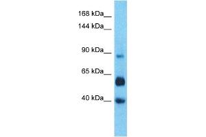 Host:  Rabbit  Target Name:  LRC66  Sample Type:  Liver Tumor lysates  Antibody Dilution:  1. (LRRC66 antibody  (C-Term))