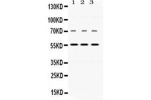 Western blot analysis of Visfatin expression in rat brain extract ( Lane 1), mouse cardiac muscle extract ( Lane 2), and human placenta extract ( Lane 3). (NAMPT antibody  (AA 62-337))