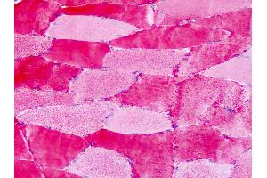 Anti-GPR30 antibody IHC of human skeletal muscle. (GPER antibody  (Extracellular Domain))