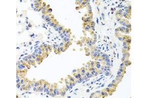 Immunohistochemistry of paraffin-embedded Mouse lung using HSPA6 Polyclonal Antibody at dilution of 1:100 (40x lens). (HSPA6 antibody)