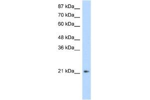 WB Suggested Anti-FERD3L Antibody Titration:  1.