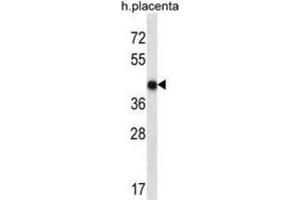 Western Blotting (WB) image for anti-Olfactory Receptor, Family 10, Subfamily V, Member 1 (OR10V1) antibody (ABIN2998186)