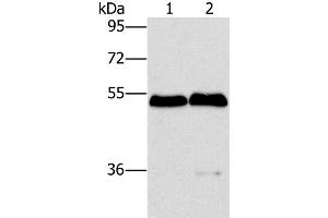 Western Blot analysis of Mouse brain and liver tissue using SPHK2 Polyclonal Antibody at dilution of 1:200 (SPHK2 antibody)