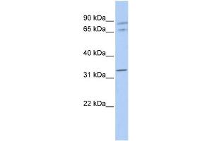 WB Suggested Anti-GJA4 Antibody Titration:  0. (GJA4 antibody  (Middle Region))