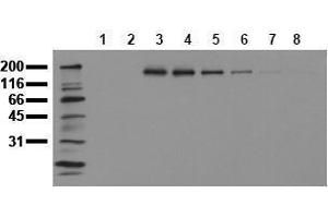 Western Blotting (WB) image for anti-Receptor tyrosine-protein kinase erbB-2 (ErbB2/Her2) (pTyr1112) antibody (ABIN126789)
