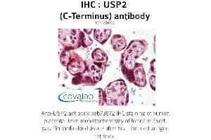 Image no. 1 for anti-Ubiquitin Specific Peptidase 2 (USP2) (C-Term) antibody (ABIN1740601)