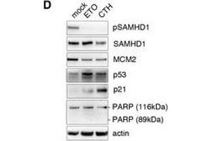 Western Blotting (WB) image for anti-Tumor Protein P53 (TP53) (N-Term) antibody (ABIN2854816)