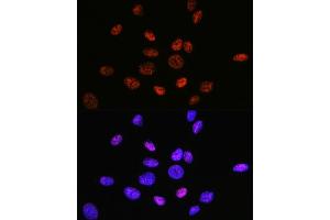 Immunofluorescence analysis of U-2 OS cells using HD Rabbit mAb (ABIN1680476, ABIN3015870, ABIN3015871 and ABIN7101453) at dilution of 1:100 (40x lens). (HDAC9 antibody)