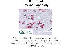 Image no. 1 for anti-Kinesin Family Member 5A (KIF5A) (Internal Region) antibody (ABIN1736222)
