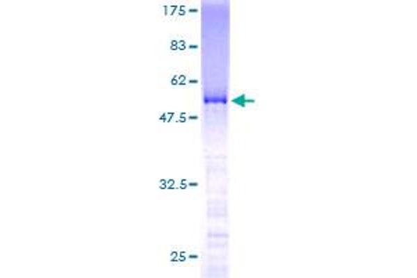SMNDC1 Protein (AA 1-238) (GST tag)