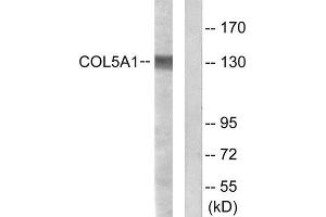 Western Blotting (WB) image for anti-Collagen, Type V, alpha 1 (COL5A1) (Internal Region) antibody (ABIN1850288)