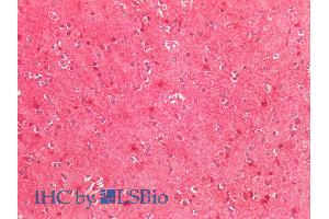 ABIN768567 (5µg/ml) staining of paraffin embedded Human Cortex. (SOD2 antibody  (Internal Region))