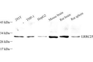 Western blot analysis of LRRC25 (ABIN7074482) at dilution of 1: 500