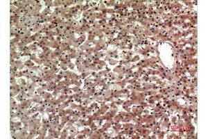 Immunohistochemistry (IHC) image for anti-Prostaglandin D2 Receptor 2 (PTGDR2) (Internal Region) antibody (ABIN6281468)