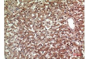 Immunohistochemistry (IHC) analysis of paraffin-embedded Human Liver, antibody was diluted at 1:100. (Prostaglandin D2 Receptor 2 (PTGDR2) (Internal Region) antibody)