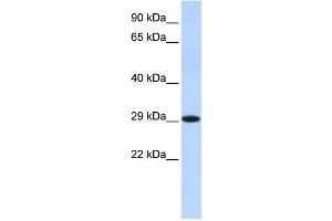 Western Blotting (WB) image for anti-Hydroxysteroid (17-Beta) Dehydrogenase 14 (HSD17B14) antibody (ABIN2459984) (HSD17B14 antibody)