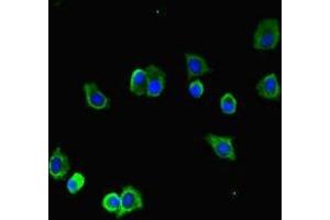 Immunofluorescent analysis of HepG2 cells using ABIN7173655 at dilution of 1:100 and Alexa Fluor 488-congugated AffiniPure Goat Anti-Rabbit IgG(H+L) (TUBA1B antibody  (AA 29-310))