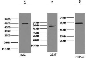 Western Blotting (WB) image for anti-Nuclear Factor-kB p65 (NFkBP65) antibody (ABIN5961203) (NF-kB p65 antibody)