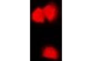 Immunofluorescent analysis of CASK staining in U2OS cells. (CASK antibody)