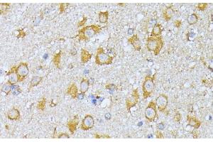 Immunohistochemistry of paraffin-embedded Mouse brain using EIF2B2 Polyclonal Antibody at dilution of 1:100 (40x lens).