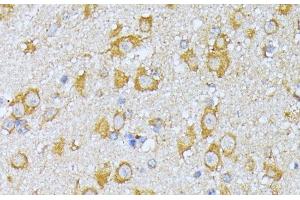 Immunohistochemistry of paraffin-embedded Mouse brain using EIF2B2 Polyclonal Antibody at dilution of 1:100 (40x lens). (EIF2B2 antibody)