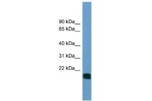 WB Suggested Anti-NT5M Antibody Titration: 0. (NT5M antibody  (N-Term))
