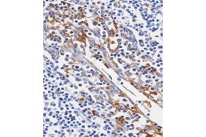 C staining LYZ in human tonsil tissue sections by Immunohistochemistry (IHC-P - paraformaldehyde-fixed, paraffin-embedded sections). (LYZ antibody  (C-Term))