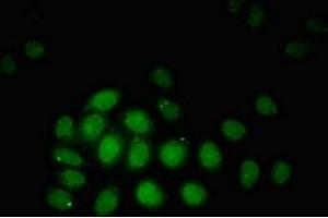 Immunofluorescent analysis of A549 cells using ABIN7172775 at dilution of 1:100 and Alexa Fluor 488-congugated AffiniPure Goat Anti-Rabbit IgG(H+L) (ZBTB33 antibody  (AA 113-228))