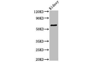 Western Blot Positive WB detected in: Mouse kidney tissue All lanes: GRK5 antibody at 3. (GRK5 antibody  (AA 406-590))