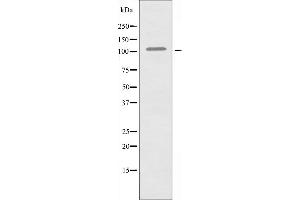 Western blot analysis of extracts from COLO205 cells, using EPHA1 antibody. (EPHA1 antibody  (Internal Region))