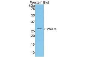 Western Blotting (WB) image for anti-Multimerin 1 (MMRN1) (AA 846-1084) antibody (ABIN1859864) (Multimerin 1 antibody  (AA 846-1084))