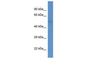 Image no. 1 for anti-1-Acylglycerol-3-Phosphate O-Acyltransferase 6 (Lysophosphatidic Acid Acyltransferase, Zeta) (AGPAT6) (AA 209-258) antibody (ABIN6746911) (AGPAT6 antibody  (AA 209-258))