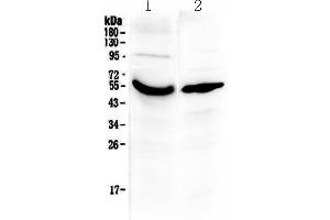 Western blot analysis of Vitamin D Binding protein using anti-Vitamin D Binding protein antibody . (Gc (AA 17-256) antibody)