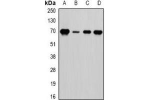 Western blot analysis of LTA4H expression in HepG2 (A), Romas (B), mouse spleen (C), mouse brain (D) whole cell lysates. (LTA4H antibody)