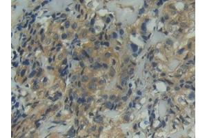 Immunohistochemistry (IHC) image for anti-Integrin alpha D (ITGAD) (AA 879-1099) antibody (ABIN7439657)