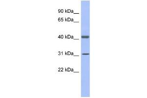 WB Suggested Anti-GAPDHS Antibody Titration:  0. (GAPDHS antibody  (N-Term))