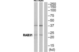 Western blot analysis of extracts from HeLa cells and HepG2 cells, using RAB31 antibody. (RAB31 antibody  (Internal Region))