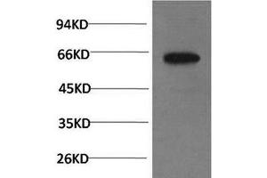 Western Blot analysis of PC-3 cells using Phospho-AKT1 (Ser473) Monoclonal Antibody at dilution of 1:1000 (AKT1 antibody  (pSer473))