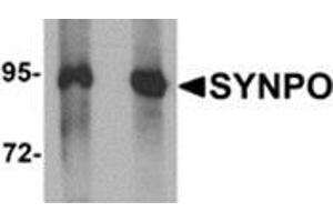 Western blot analysis of SYNPO in Rat brain tissue lysate with SYNPO antibody at (left) 1 and (right) 2 μg/ml. (SYNPO antibody  (C-Term))