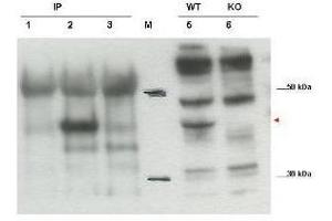 Western blot using  affinity purified anti-Cybr antibody shows detection of endogenous Cybr from mouse splenocytes using anti-Cybr antibody to immunoprecipitate and western blot (lanes 1-3). (CYTIP antibody  (C-Term))