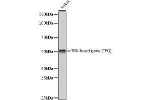Western blot analysis of extracts of Jurkat cells, using TRK fused gene (TFG) (TFG) Rabbit mAb (ABIN1512690, ABIN3022090, ABIN3022091 and ABIN7101442) at 1:3000 dilution. (TFG antibody)