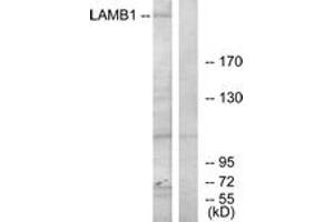 Western blot analysis of extracts from HepG2 cells, using LAMB1 Antibody.