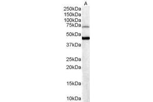ABIN184820 (0. (FOXG1 antibody  (C-Term))