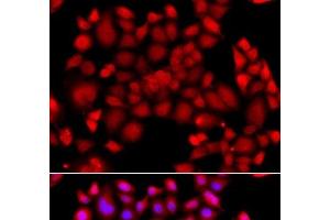 Immunofluorescence analysis of A549 cells using PIP4K2B Polyclonal Antibody (PIP4K2B antibody)
